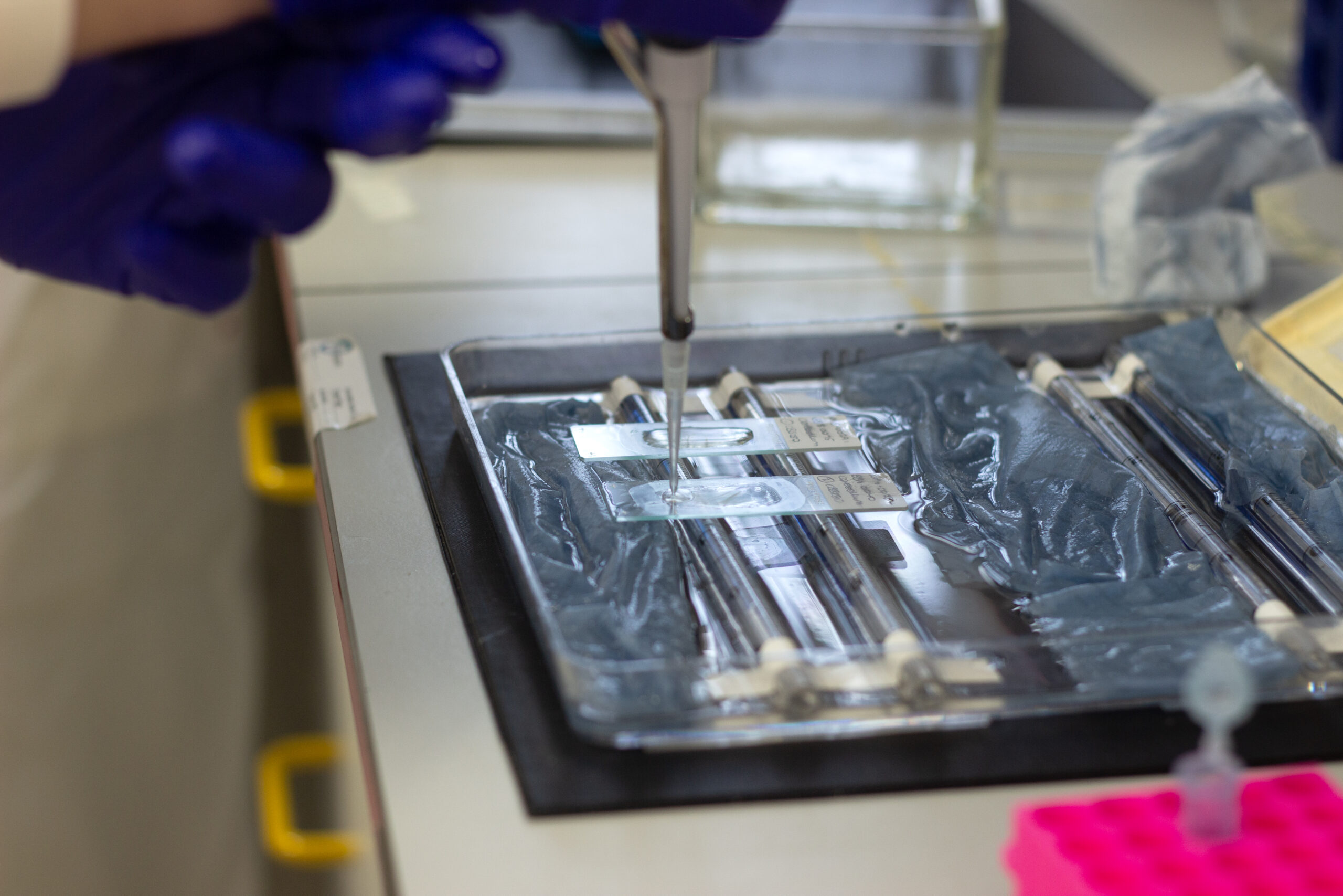 Ferrer advances research into PSP