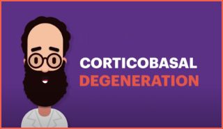 Corticobasal Degeneration